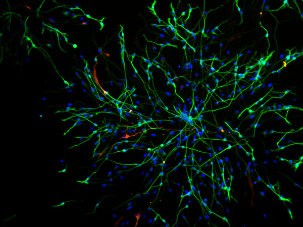 倒置荧光显微镜图片