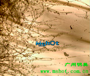 奥林巴斯生物显微镜 OLYMPUS BX43 拍摄图